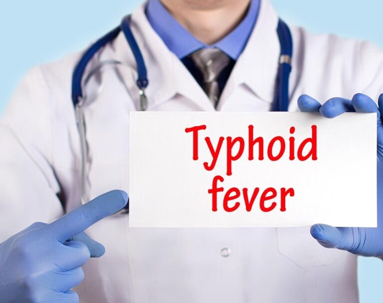 Typhoid